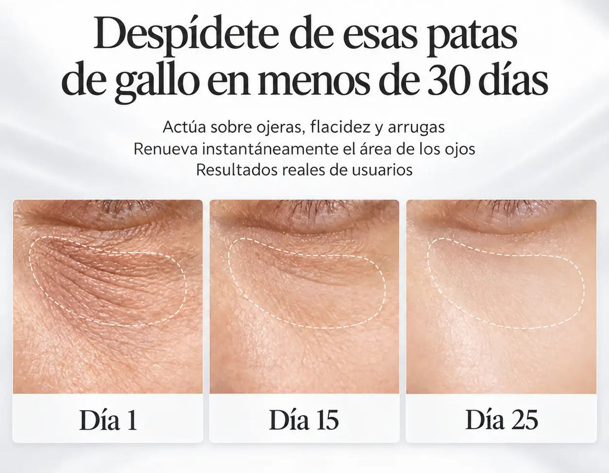 Imagen de Landing
