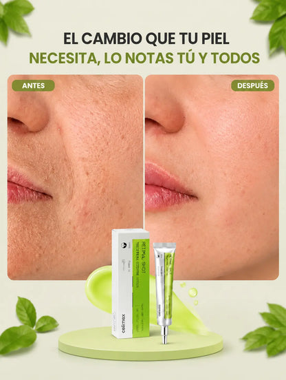 Crema viral Retinal Shot® - vuelve 10 años atrás.